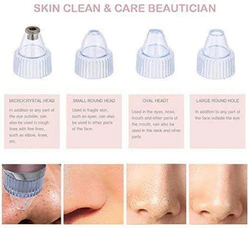 🔥 GlowSkin Pore Cleaner – Electric Blackhead Remover & Deep Pore Vacuum for Clear Skin